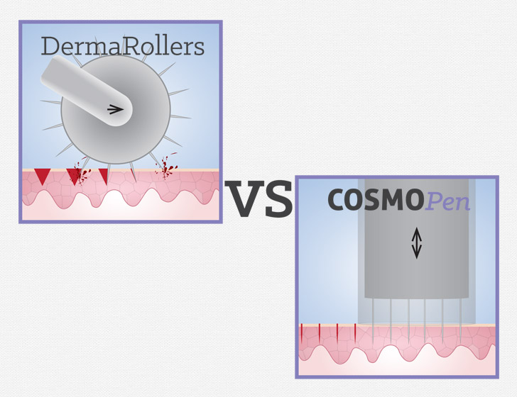 Cosmopen vs Dermarollers