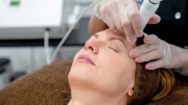 Skin Laser treatment
